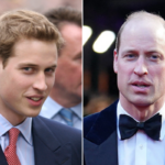 Prince William Transformation