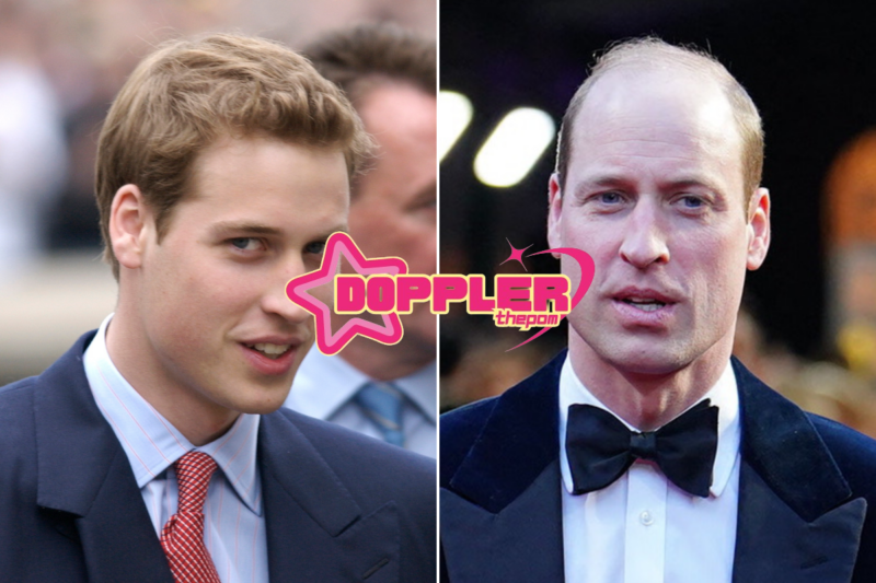 Prince William Transformation